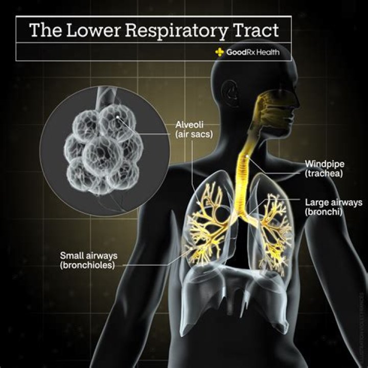 Can a cold turn into bronchitis or pneumonia?