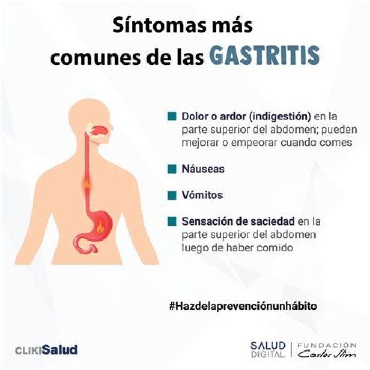 ¿Cuáles son los síntomas del dolor de gastritis?