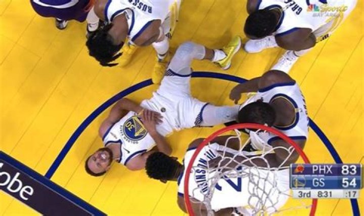 Did Curry break his hand?