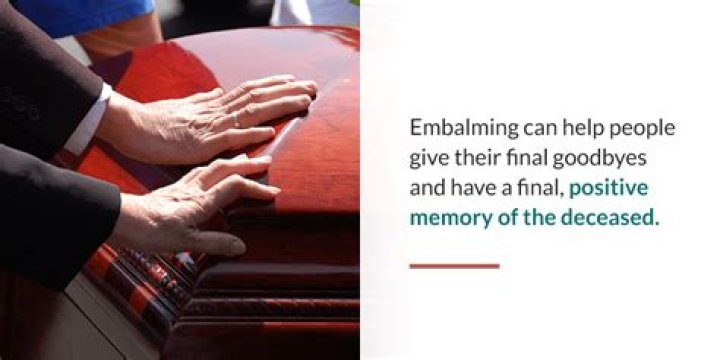 Do you need to be embalmed when you die?