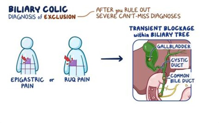 Does biliary colic go away?