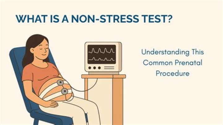 Does every pregnant woman get a non stress test?