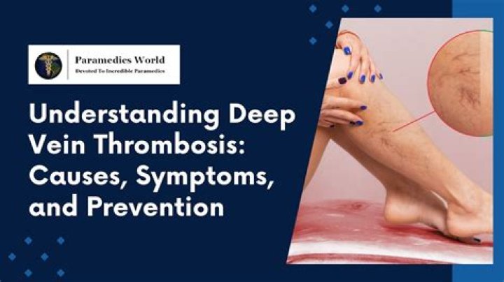 How can DVT be prevented?