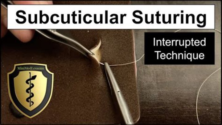 How do you start a Subcuticular suture?