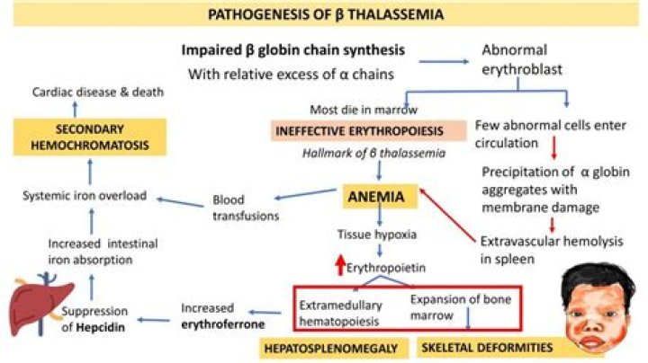 Is beta thalassemia rare?