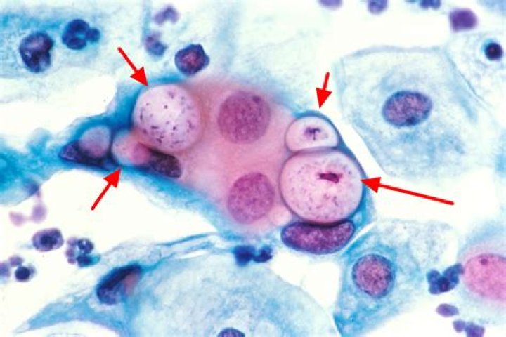 Is chlamydia a parasite or bacteria?