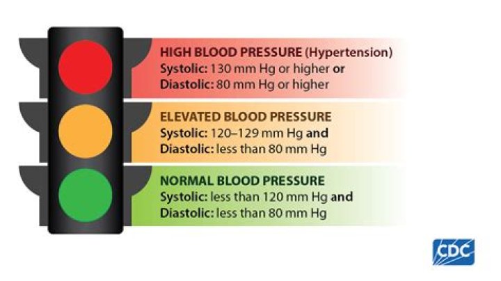 Is Norvasc good for high blood pressure?