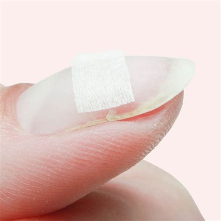 Should I put a bandaid on a broken nail?