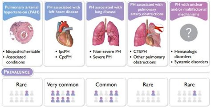 What are common complications of pulmonary artery pressure monitoring?