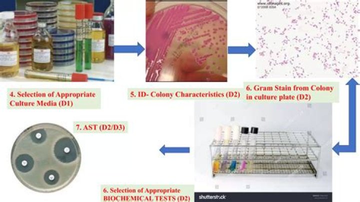 What are the biochemical test for bacteria identification?