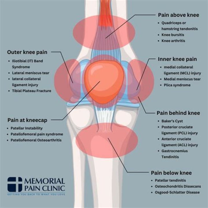 What are the causes of anterior knee pain?