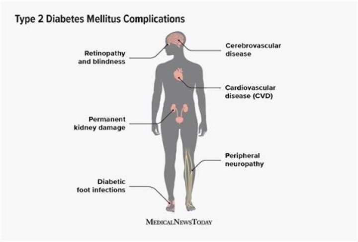 What are the complications of Type 2 diabetes?
