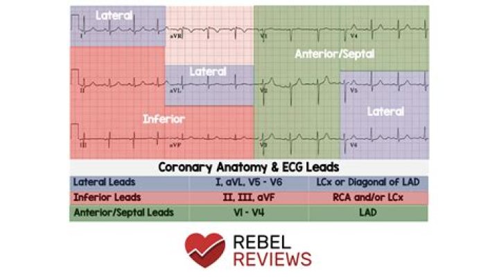What are the lateral leads?