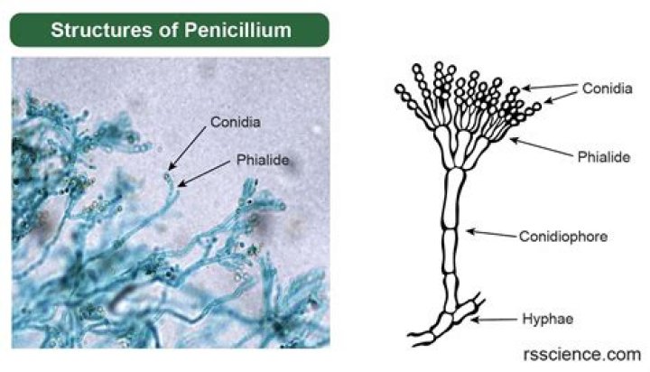 What Color Is penicillium mold?