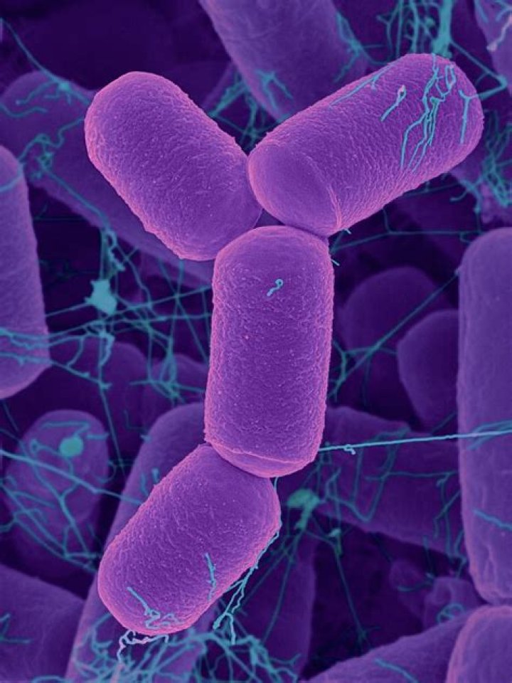 What do archaebacteria look like?