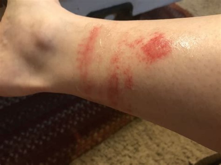 What does a wool allergy look like?