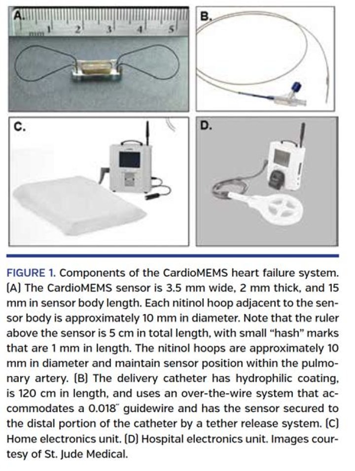 What does CardioMEMS measure?