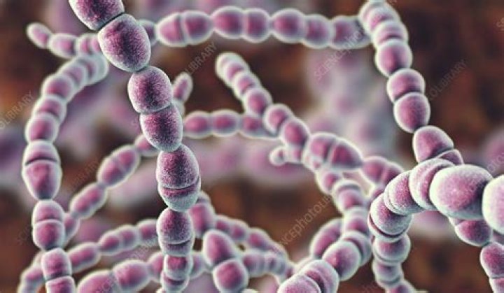 What does Streptococcus salivarius cause?
