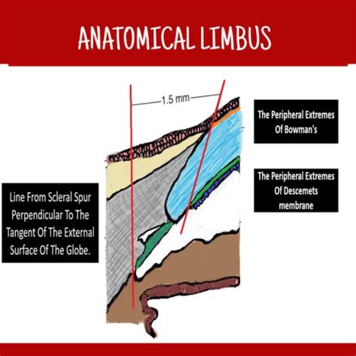 What impact does the limbus have when damaged?