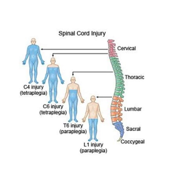What is a t5 spinal injury?