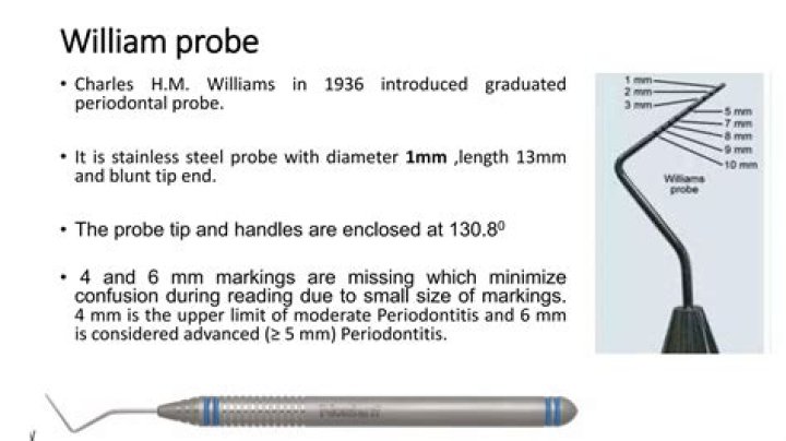 What is a Williams probe used for?