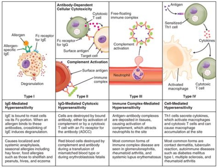 What is an immune complex disease?