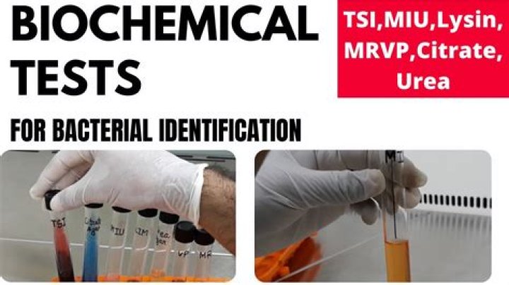 What is biochemical test microbiology?