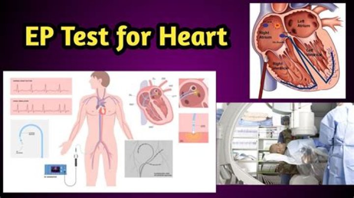 What is EP blood test?