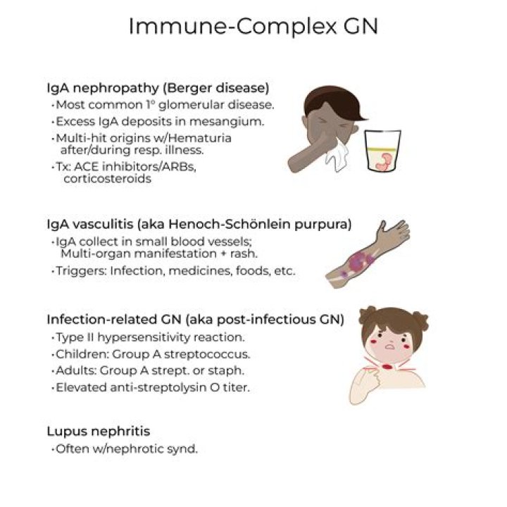 What is immune complex glomerulonephritis?
