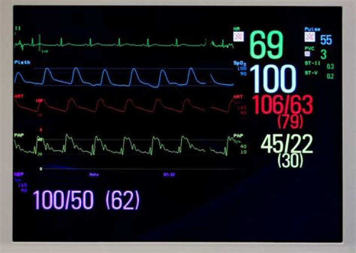 What is PAP on a heart monitor?