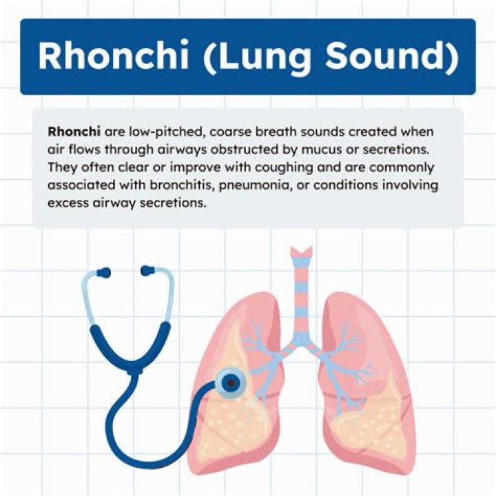 What is Rhonchi a sign of?