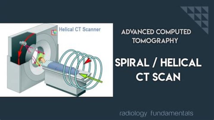 What is spiral CT angiography?