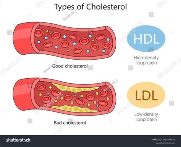 What is the bad cholesterol?