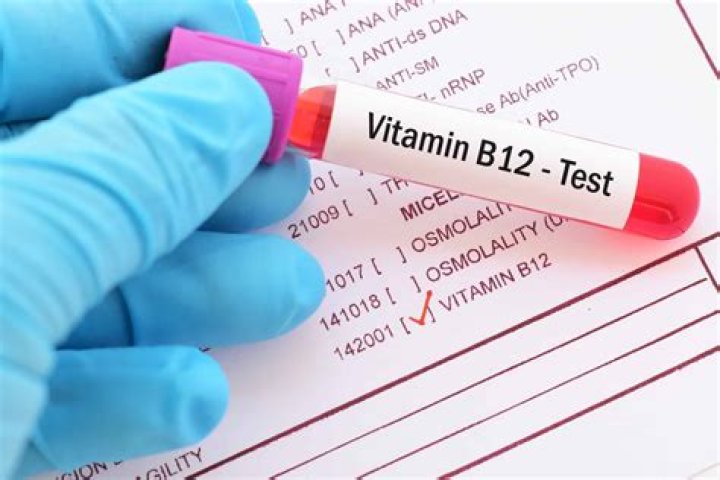 What is the blood test for vitamin b12?