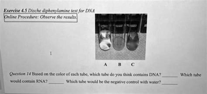 What is the dische test?