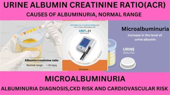 What is the normal range for microalbumin creatinine ratio?