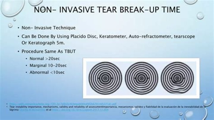 What is the normal tear break up time?