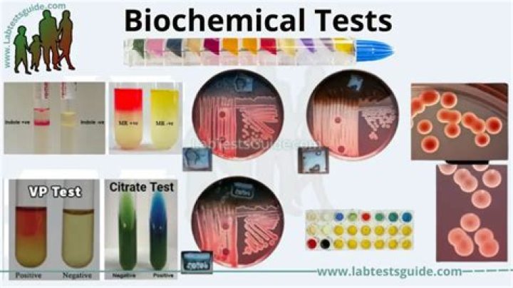 What is the principle of biochemical test?