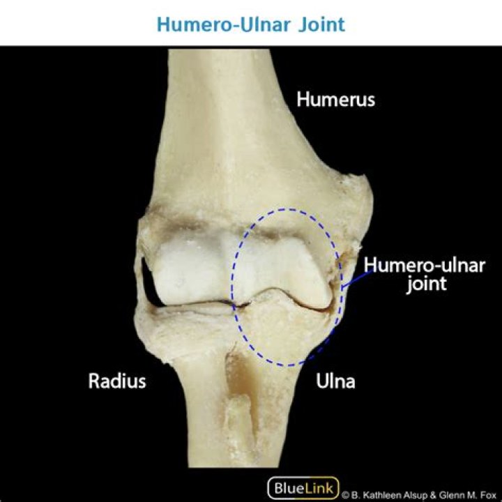 What is the Ulnohumeral joint?