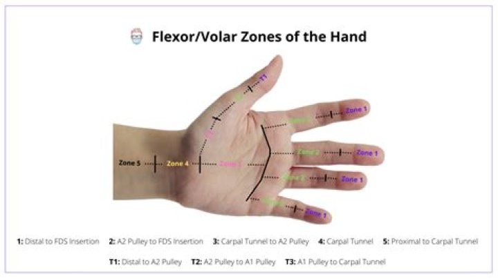What is volar aspect of hand?