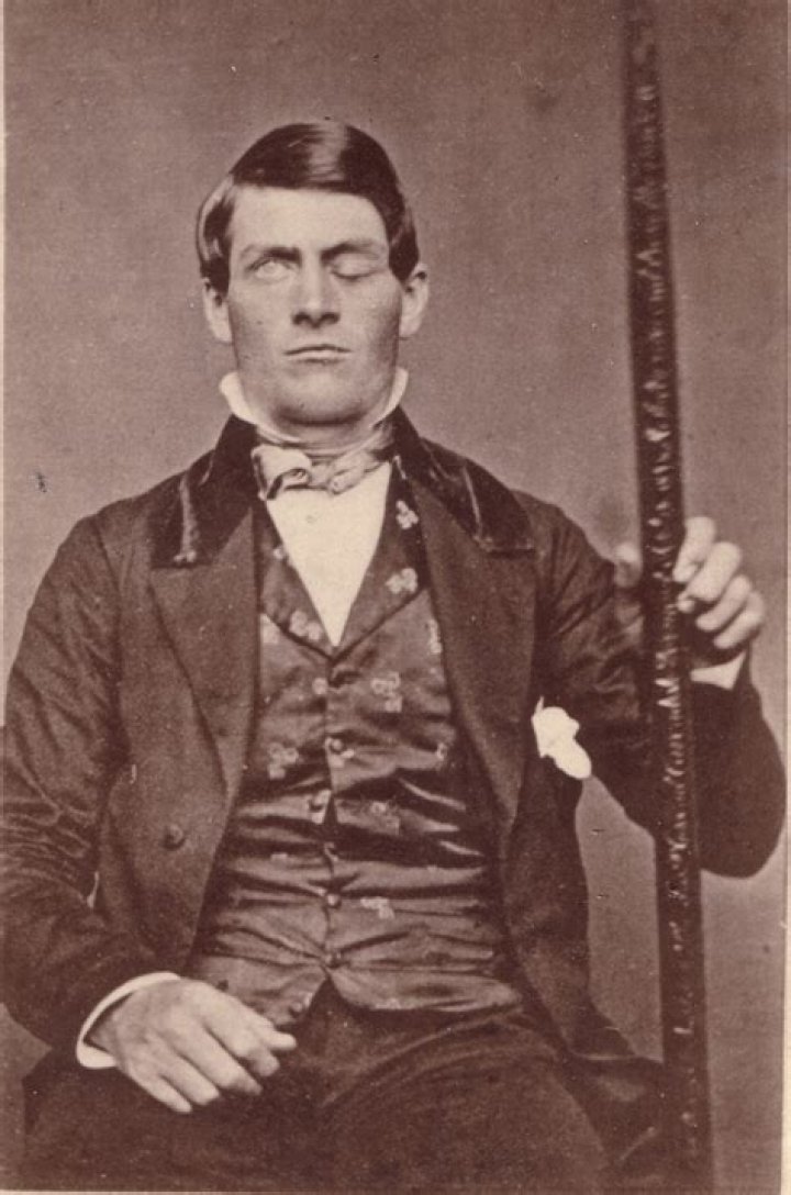 What part of Phineas Gage's brain was injured?