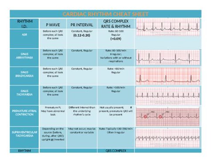 Which rhythms do you Cardiovert?