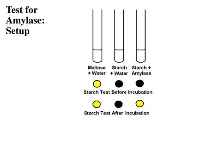 Why amylase test is done?