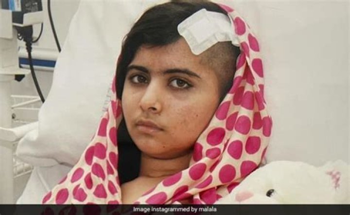 Why did Malala get shot in the head?