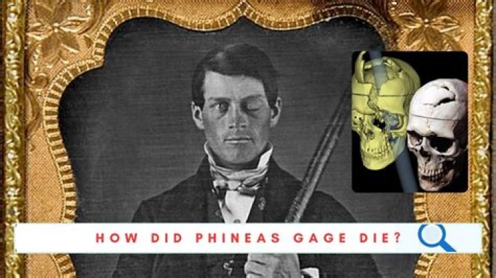 Why did Phineas Gage die?