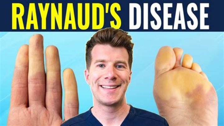 Why do I suddenly have Raynaud's?