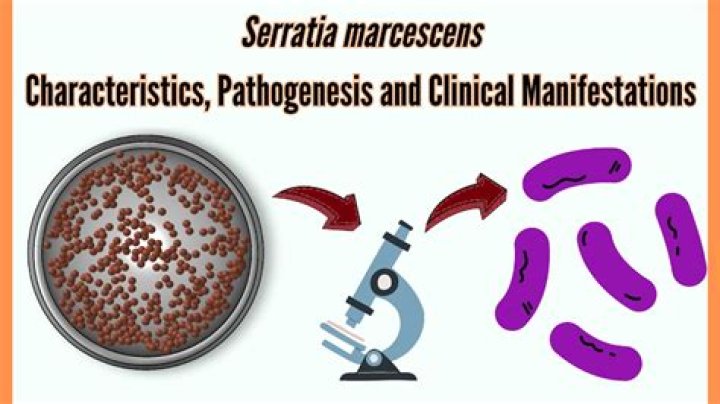 Why does Serratia marcescens turn pink?