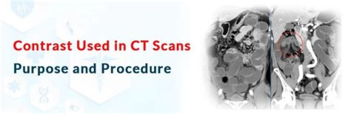 Why is contrast used in CT?